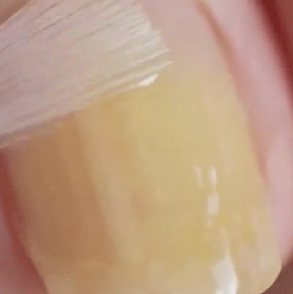 Last Day Of Discount 🔥 Nail Repair & Antifungal Solution